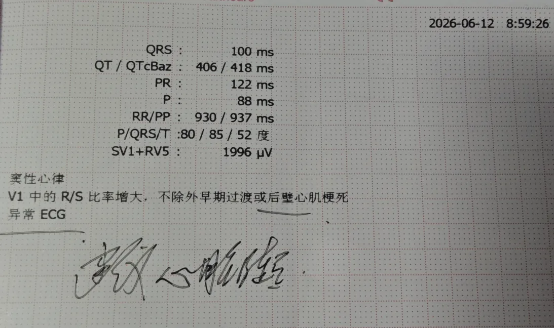 心电图结果